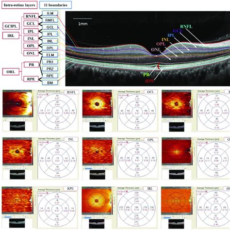 thickness measurement of retinal layers|retinal thickness treatment.